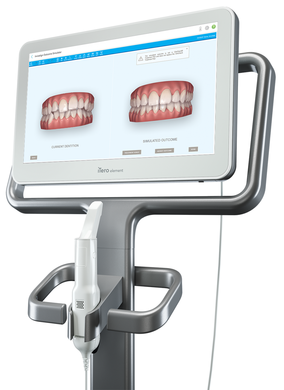 Scanner iTero com visualização digital do sorriso